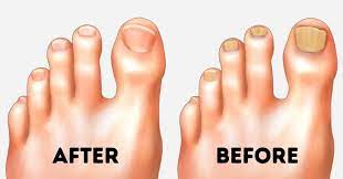 Check spelling or type a new query. 10 Easy Tips To Make Your Feet Look Perfect