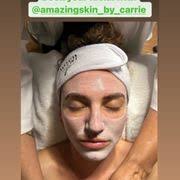 AMAZING SKIN BY CARRIE