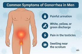 Image result for gonorrhea symptoms