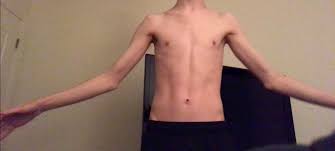 Bmi is a calculation of height and weight, so you'll see most of these pages marked with a single bmi number, regardless of how much muscle or fat the individuals are carrying. 18m 6 1 115 Lbs 140lbs Album On Imgur