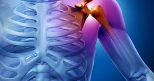 Find Clavicle Fracture Surgeon For Cyclists In Orange County By Howard Marans Md Shoulder Replacement Surgery Natural Care Shoulder Stretches
