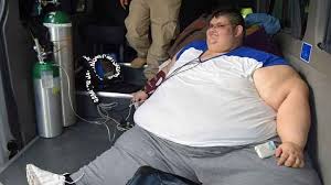 Un record qu'il doit uniquement au régime drastique du mexicain manuel uribe qui a perdu la moitié de ses 590 kilos depuis son mariage l'année dernière. Obesite L Homme Le Plus Gros Du Monde Va Tenter De Perdre La Moitie De Son Poids Soit 300 Kg