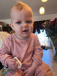 This maybe a long shot but my 10 month old has bilateral cerebral palsy,  and is trying so hard to crawl but every time she moves her head drops  multiple times and