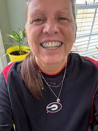 Recovery from double jaw joint replacement surgery