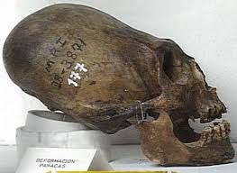 Alien Skulls Not Even Close Archaeology Review All around the world evidence of an elongated headed race is found. alien skulls not even close
