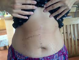 Browse 1,353 female internal organs stock photos and images available, or start a new search to explore more stock photos and images. Mum S Internal Organs Crushed By Obese Woman In Holiday Water Slide Horror Daily Record