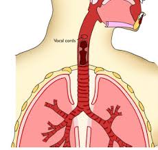 Image result for Stridor