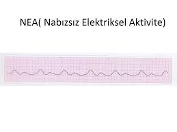 Düzeyleri exitus olanlardan yüksekti (p=0.001). Ileri Yasam Destegi Beu Zonguldak Saglik Yuksekokulu Hemsirelik Bolumu Ppt Indir