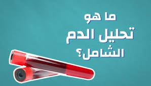 ما هو تحليل cbc لمكونات الدم ولماذا يطلب الاطباء هذا الفحص؟ تحليل cbc لمكونات الدم هو أحد أبسط أنواع التحاليل الطبية وأكثرها شيوعا، ولا يعتبر اختبارا نهائيا، لكنه يساعد في كشف بعض الاضطرابات التي قد تؤثر على الصحة العامة، وبشكل أكثر دقة يحدد تحليل cbc. Ù…Ø§ Ù‡Ùˆ ØªØ­Ù„ÙŠÙ„ Ø§Ù„Ø¯Ù… Ø§Ù„Ø´Ø§Ù…Ù„ Ù…ÙˆØ¶ÙˆØ¹