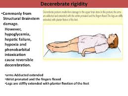 Coma Clinical Examination