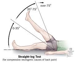 After all, the infamous sciatica pain is caused by unhappy nerves. Sciatica Causes Symptoms Treatment Prevention Pain Relief