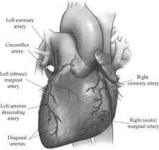 Left coronary artery left circumflex. Number Of Diagonal Arteries Coronary Artery Bypass Surgery Heart Bypass Redirects Here