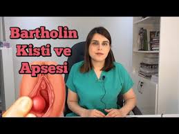 Bartolin Bezi Bartolin Apsesi Nedir Op Dr Korkut Arslan Youtube