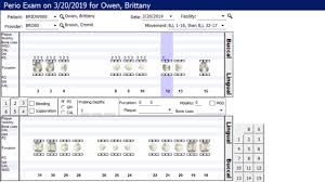 Perio Charting Dental Software Tip