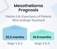 It is known that chrysotile asbestos causes asbestosis, and this is one of the six different. Mesothelioma Prognosis Factors Affecting Life Expectancy