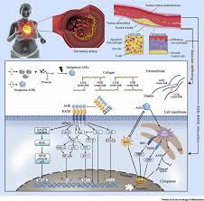 Clinical Translational Aspects Of Advanced Glycation End Products Trends In Endocrinology Metabolism