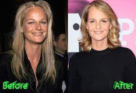 This situation caused comments about helen hunt's new appearance. Helen Hunt Before And After Plastic Surgery Helen Hunt Plastic Surgery Celebrity Plastic Surgery