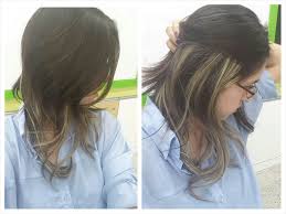 The most common symptom of vitiligo is light or depigmented spots on the skin. Vitiligo Keepingaccount Kr