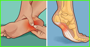 16 effective home remes for swollen feet