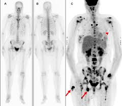 The Pan African Medical Journal Image Quiz