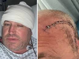 Dad rushed to hospital with ear infection finds out he has inoperable brain  tumour