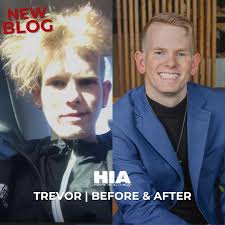 🚨Check out the latest HIA article featuring Senior Program Manager,  Trevor! 🚨 #hia #blog#before #after #radicallifechange #hope  https://hopeisalive.net/before-and-after-trevor-mathis/ 👈