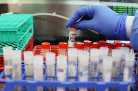 Meanwhile pharmaceutical group astrazeneca has said it will join forces with german company idt biologika to produce more vaccines for europe. Eu Administers Just Third More Covid Vaccines Than Uk Total Evening Standard
