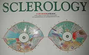 Exact Sclerology Chart Emotional Iridology Chart Iridology