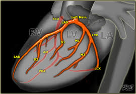 To get the indexes of numbers on the diagonal that starts from left most element in top row ,from the array containing all the numbers in the matrix; The Radiology Assistant Coronary Anatomy And Anomalies