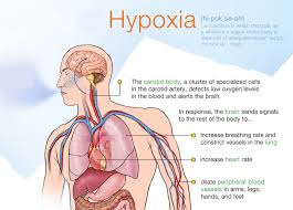 The term silent hypoxia (also happy hypoxia) refers to hypoxia that does not coincide with shortness of breath. Covid 19 Hypoxia New Research Provides Possible Explanations For Happy Hypoxia Phenomenon In Covid 19 Patients Thailand Medical News