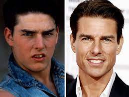 We did not find results for: 114 Incredible Before After Transformations Of People Who Wore Braces Bored Panda