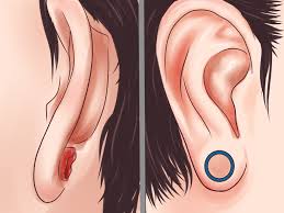 If your ears don't pop after this, you should get checked for hearing loss. How To Get Rid Of A Blowout The Quickest And Easiest Way 7 Steps