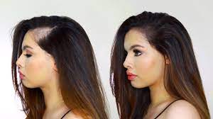 If your locks are thinning due to pregnancy, there's no special treatment required. My Postpartum Hair Loss Alexandrasgirlytalk Youtube