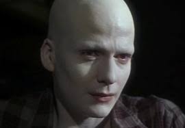 Clinicaltrials.gov lists trials that are related to alopecia universalis. Alopecia Universalis Marbo