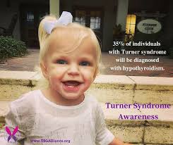 Turners Syndrome- Tulip