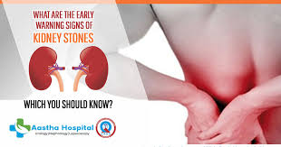 Testicular cancer is cancer that develops in the testicles, a part of the male reproductive system. What Are The Early Warning Signs Of Kidney Stones Which You Should Know