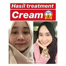 �treatment cream puteri ratu�, jawi, pulau pinang, malaysia. Puteri Ratu Treatment Cream Harga Murah Borong Original 60102559481