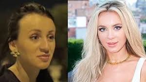 Omg this is Yara before and after!!!