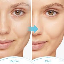 Amazon.com : CONBELLA Cold Face Eye Masks Ice Face Mask Hot Cold Compress  For Dark Circles, Puffiness, Migraines, Headache, Stress, Redness, Cooling  ...