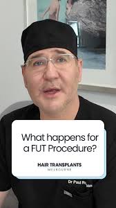 Dr. Paul Robinson explains what happens to the donor area during a FUT  procedure
