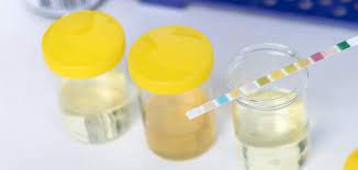 يواجه التقارب حفرة متى يعرف الحمل عن طريق البول findlocal drivewayrepair com