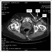This means that the figures and tables are numbered consecutively throughout the document. A Laparoscopic View Of A Gangrenous Appendix Epiploica On The Surface Download Scientific Diagram