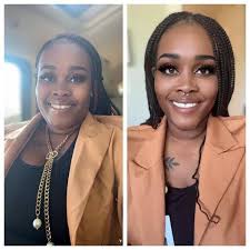 Is it normal to have chest pain ? I was also wondering does everyone else  have had their SMAS get worse over time ... I used to be able to eat "for