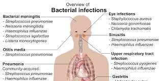 Overview Of The Main Bacterial Infections And The Most Notable Species Involved Nursing Notes Nursing Tips Bacterial Infection