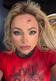 We don't deserve all these injuries, wishing you a speedy recovery Bud.