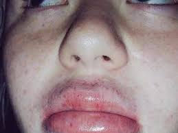 The kylie cosmetics founder discussed the insecurity she had. Kylie Jenner S Lip Challenge On Instagram