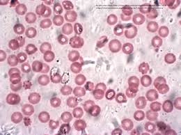 Image result for Red Blood Cell