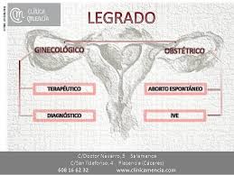 Clinica Mencia Te Informa Legrado Uterino