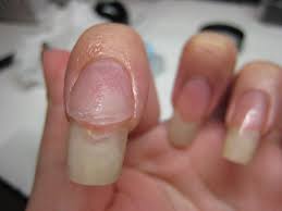 Jin Jin S Adventures Acrylic Overlay Nail Art Using Nails Acrylic Nail French Tip Designs Shor Acrylic Nail Designs Take Off Acrylic Nails Overlay Nails