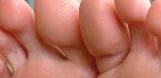 Welche hausmittel gegen hornhaut gibt es und welche sind erfolgsversprechend. Wie Sie Ihre Hornhaut Entfernen Konnen Frauenseite Beauty Tipps Frauenseite Ch